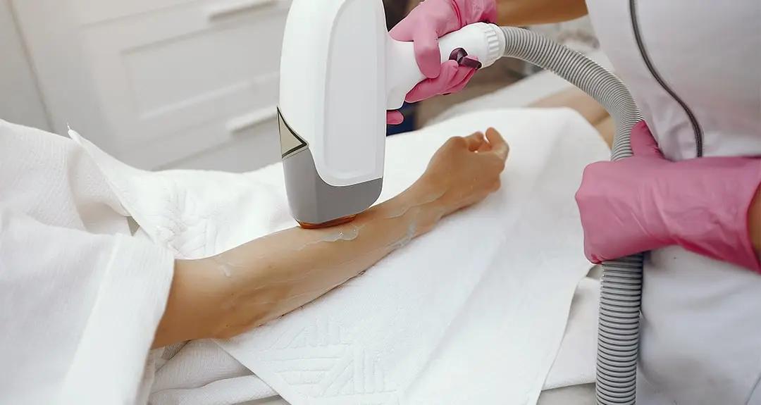 Laser Hair removal in Noida