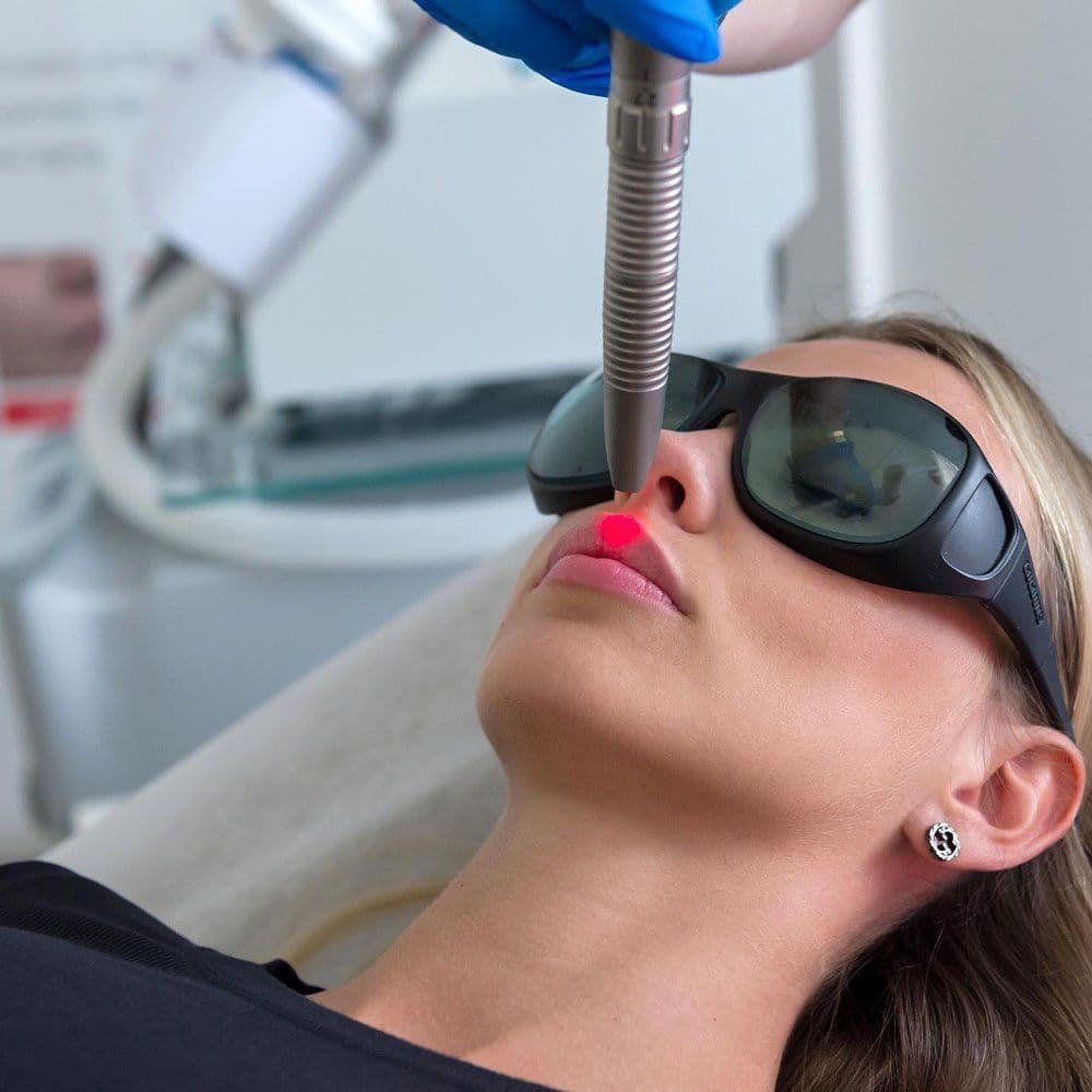 Lip Chemical Peel For Women