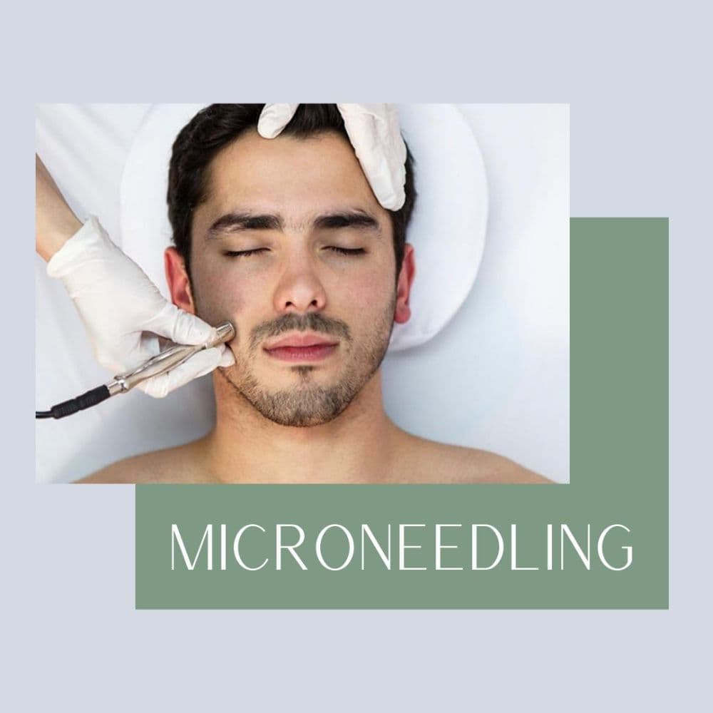 Microneedling for Men 