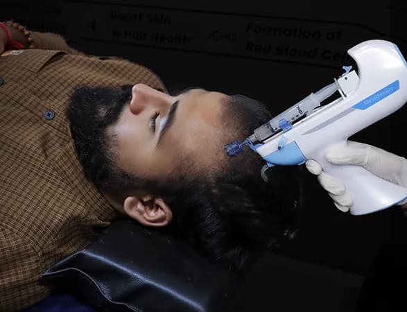 Hair Mesotherapy