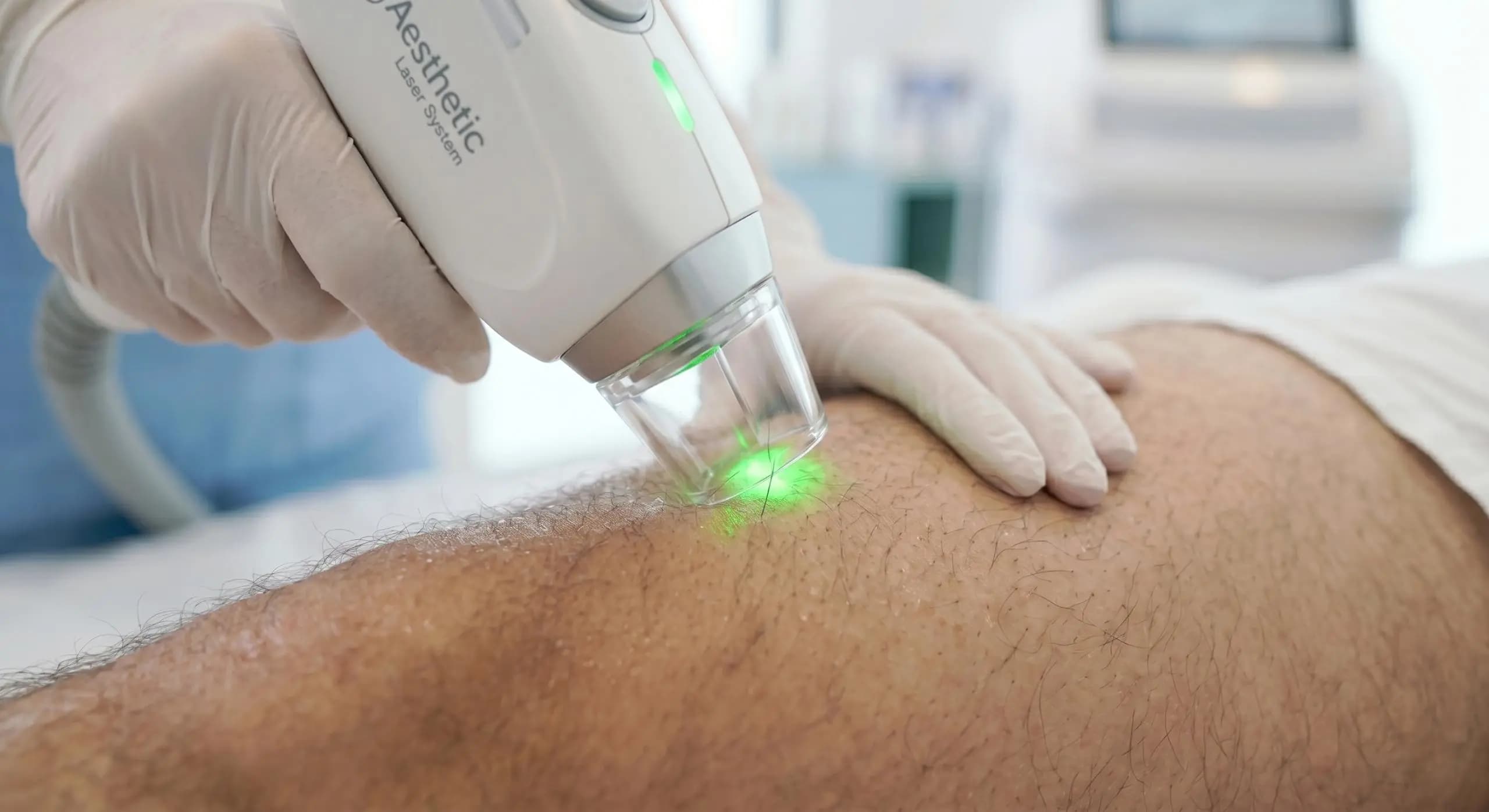 Full Body Laser Hair removal for Men 5