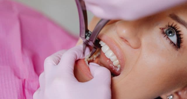 Root Canal Treatment