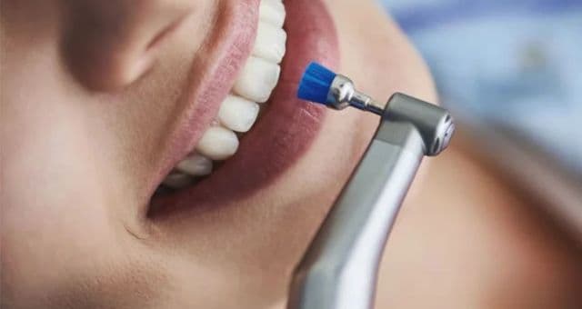 Teeth Cleaning