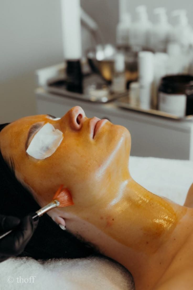 Yellow Chemical Peel For Women