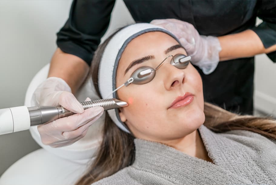 Q-Switch Laser Treatment