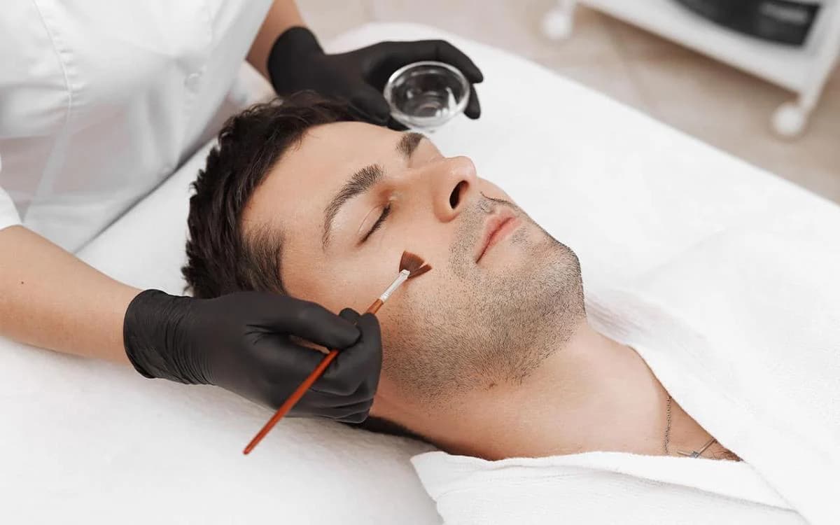 Glycolic peel