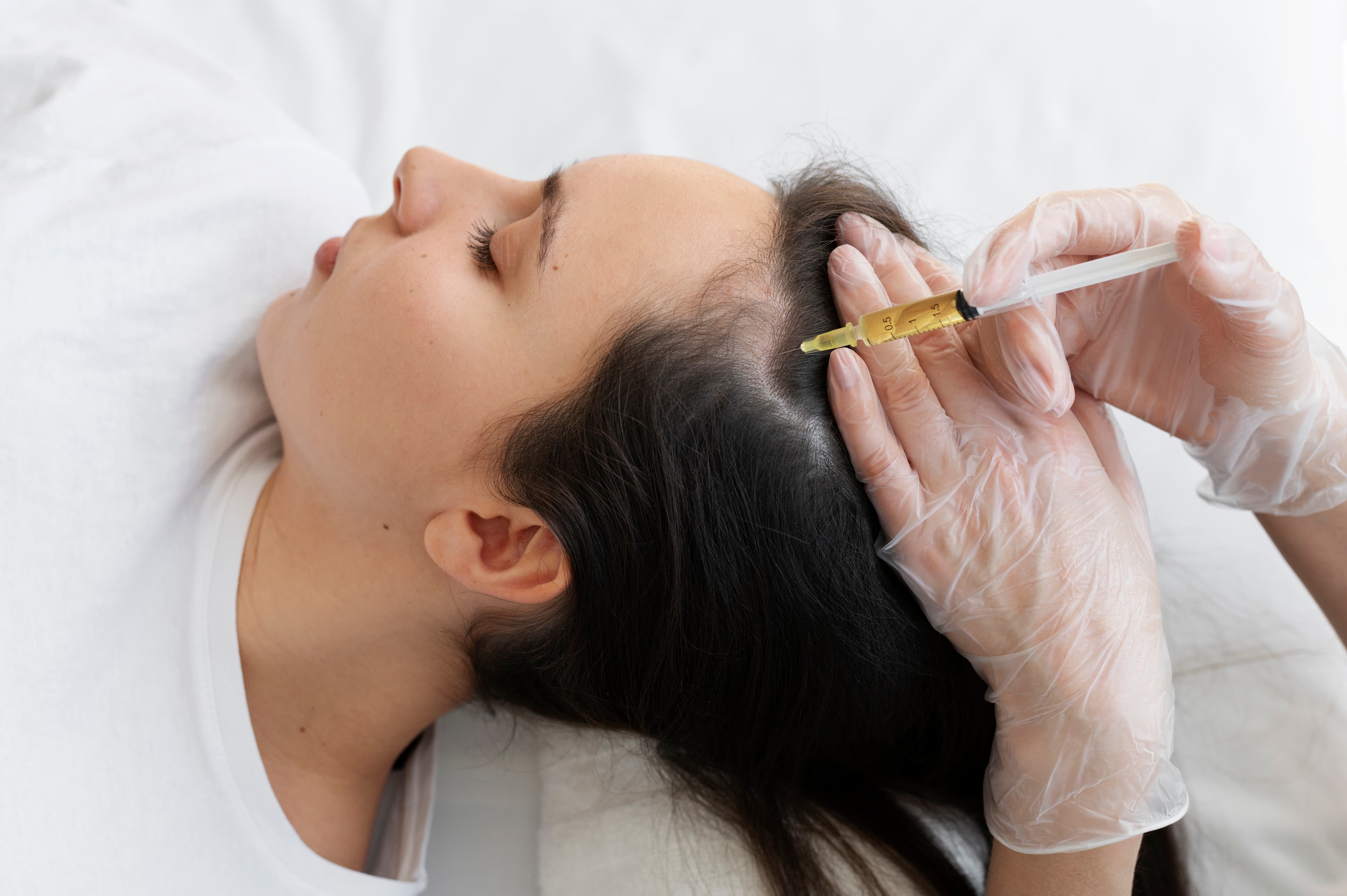 Hair Mesotherapy