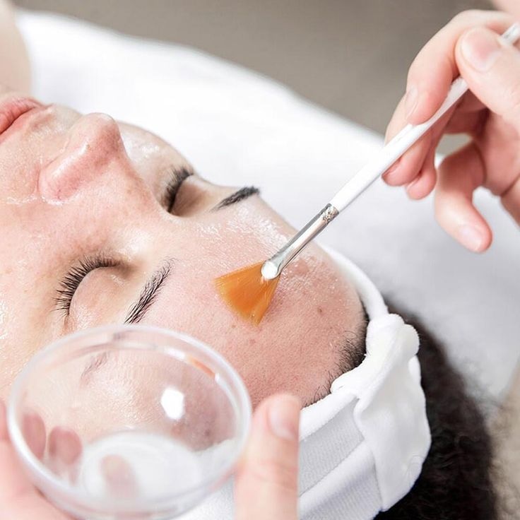 Glycolic Chemical Peel for Women