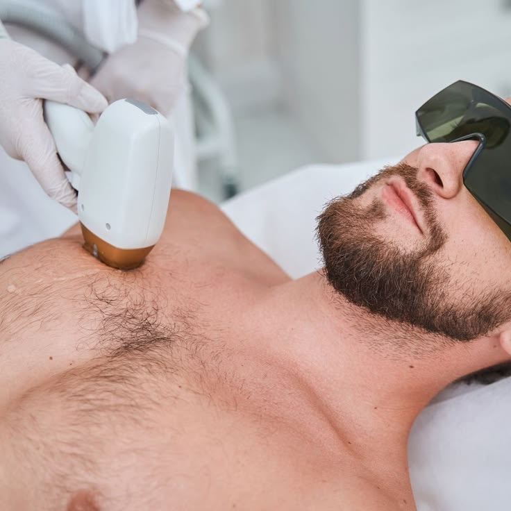 Full Body Laser Hair removal for Men