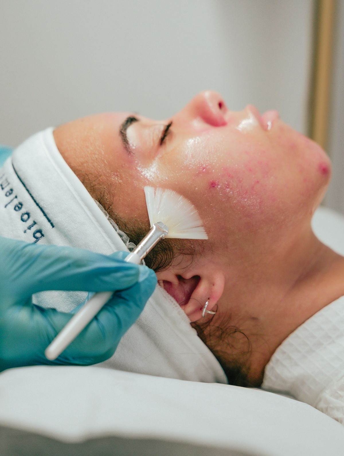 Mandelic Chemical Peel For Women