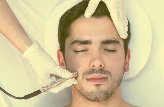 Microderma Abrasion For Men