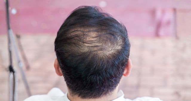 Hair GFC